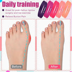 Set of 5 Toe Stretcher Band Separator Spacer Bunion Correction Hallux Valgus Alignment Foot Stretcher Straightener Resistance Loop Yoga Exercise Foot Care with Carry Bag(Pink)