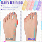 Set of 5 Toe Stretcher Band Separator Spacer Bunion Correction Hallux Valgus Alignment Foot Stretcher Straightener Resistance Loop Yoga Exercise Foot Care with Carry Bag(Pastel)